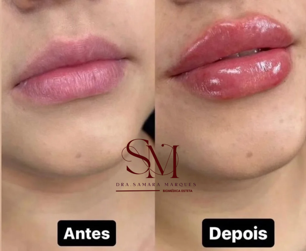 Cliente satisfeita com a Dermalyn